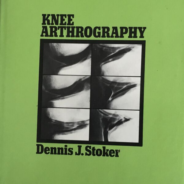 Knee Arthrography